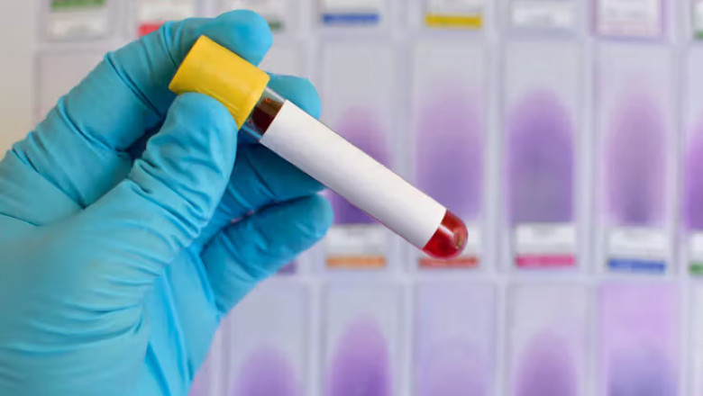 ELISA Method in Diagnostics: Key Applications in Disease Detection