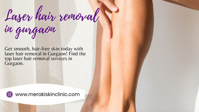 Gurgaon’s Best-Kept Secret: Achieve Smooth Skin with Laser Hair Removal