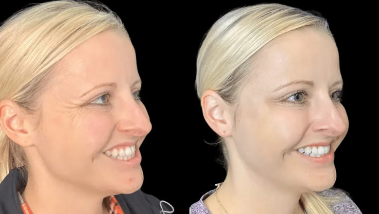How the Best Aesthetic Clinic in Dubai Ensures Patient Safety