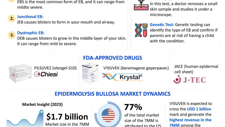 Epidermolysis Bullosa (EB) Overview