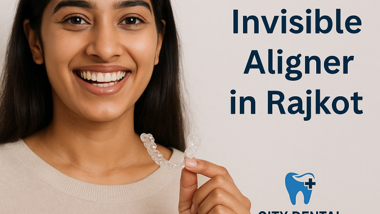 Can invisible aligners stain your teeth or get stained themselves?