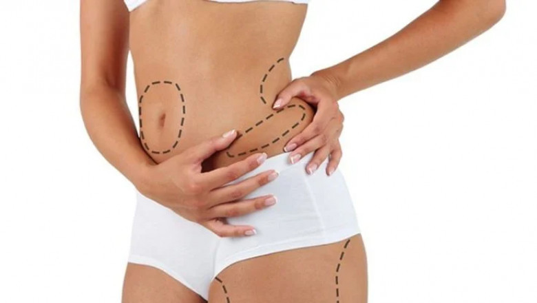 Understanding the Cost of Fat Transfer in Dubai and What You Get for Your Money