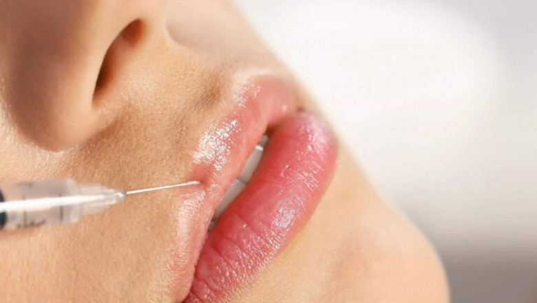 How to Choose the Right Injector for Russian Lips