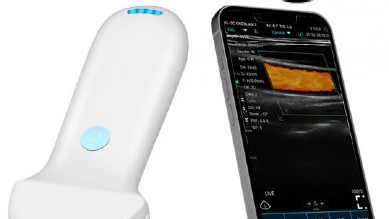 High Frequency Handheld Ultrasound Scanner