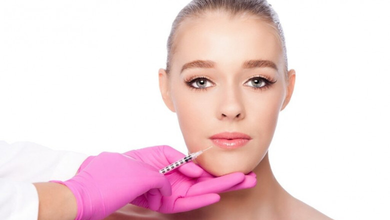 Techniques Used in Russian Lip Filler Application