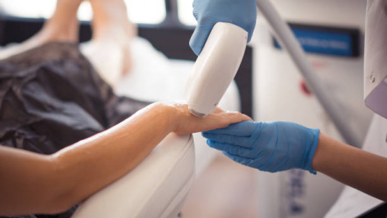 The Ultimate Guide to Laser Hair Removal in Toronto