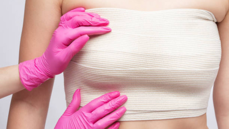 Breast Reconstruction Market Trends and Growth Analysis