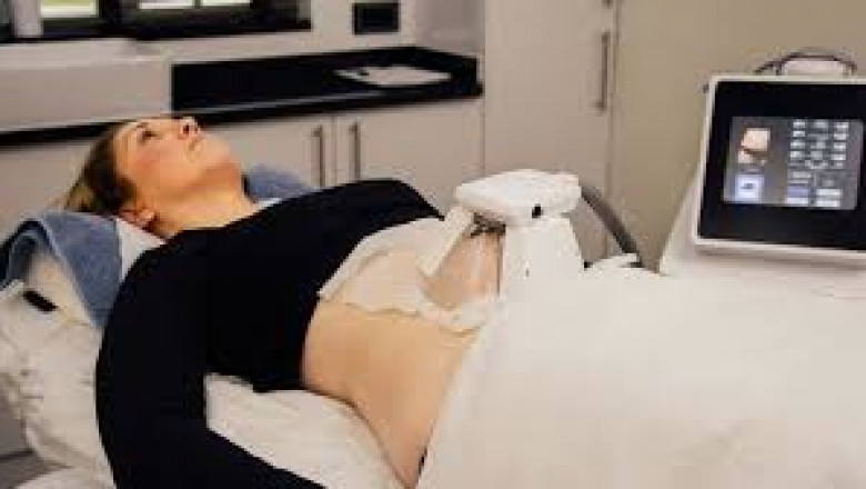 Everything You Need to Know About FAT REMOVAL TREATMENT Islamabad