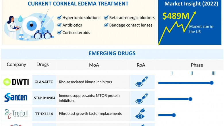 Overview of Corneal Edema