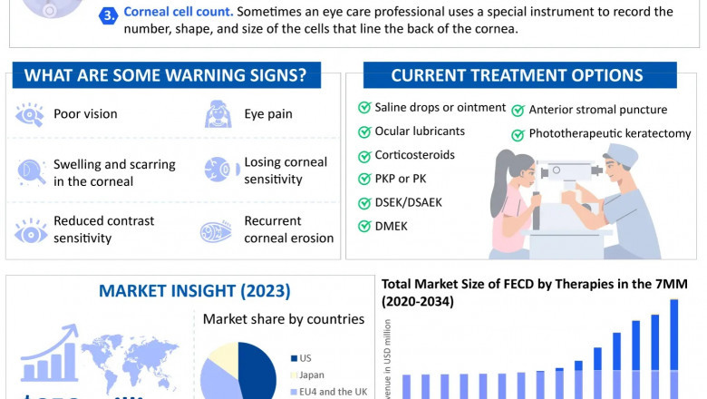 Overview of Fuchs Endothelial Corneal Dystrophy (FECD)