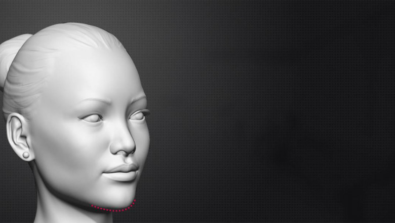 How to get feminine jawline with chin reduction surgery?