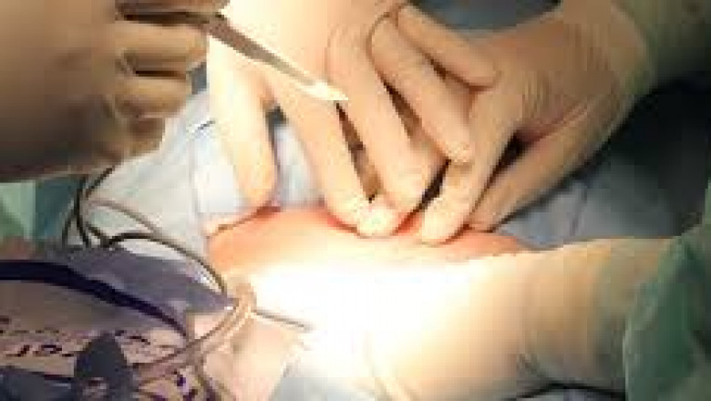 Mixed Billing Doctors In Chapel Hill and Health Care Medical Centre