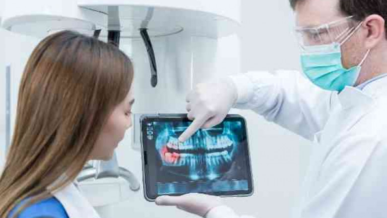 The Role of an Emergency Dentist in Treating Tooth Injuries