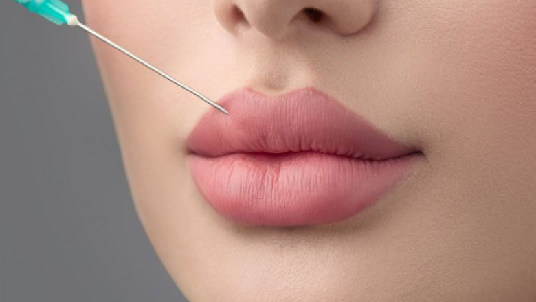 Russian Lip Fillers: Expert Advice from the Best Plastic Surgeons in Dubai