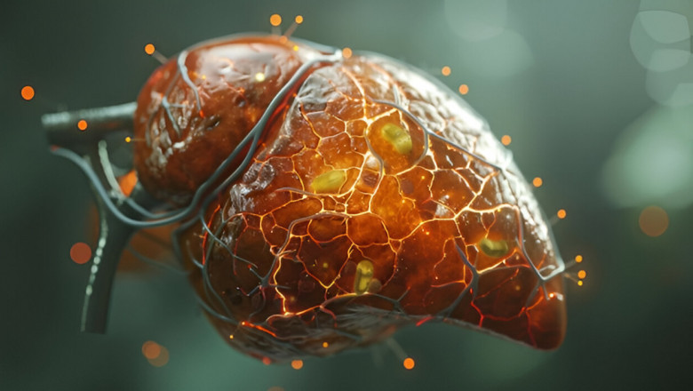 Advances in Primary Biliary Cirrhosis Treatment: Market Trends and Therapeutic Innovations