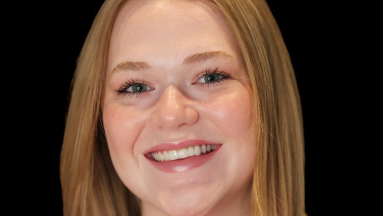 Using Invisalign in Savannah GA