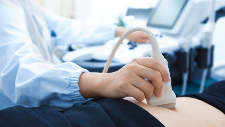 Brazil Ultrasound Devices Market Size, Share and Growth Forecast 2025-2033