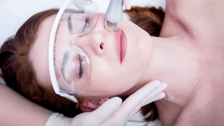 Post-Laser Treatment Care: Your Ultimate Recovery Guide