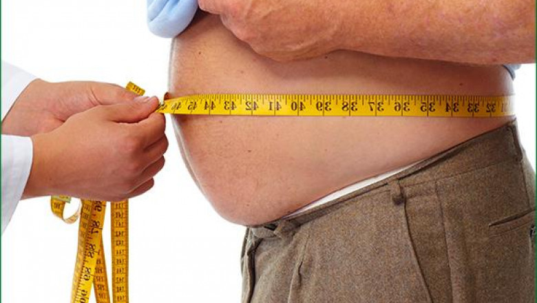How Lifestyle Changes Complement Obesity Treatment Dubai for Lasting Results