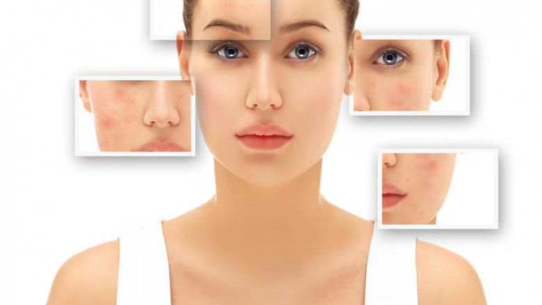 Summer Glow Guard Combo: Your 5-in-1 Shield for Glowing Skin and Hair