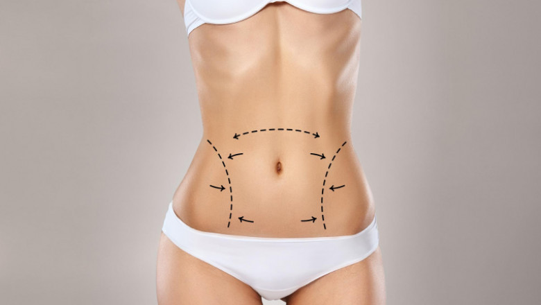 How Mini Tummy Tuck in Dubai Can Benefit Your Post-Pregnancy Body