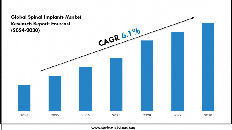 Spinal Implants Market Overview 2024–2030: Demand & Future Trends