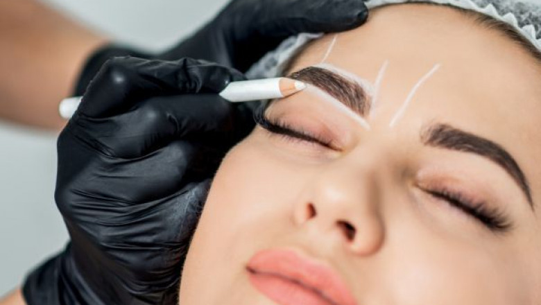 Eyebrow Transplant: Frequently Asked Questions Answered